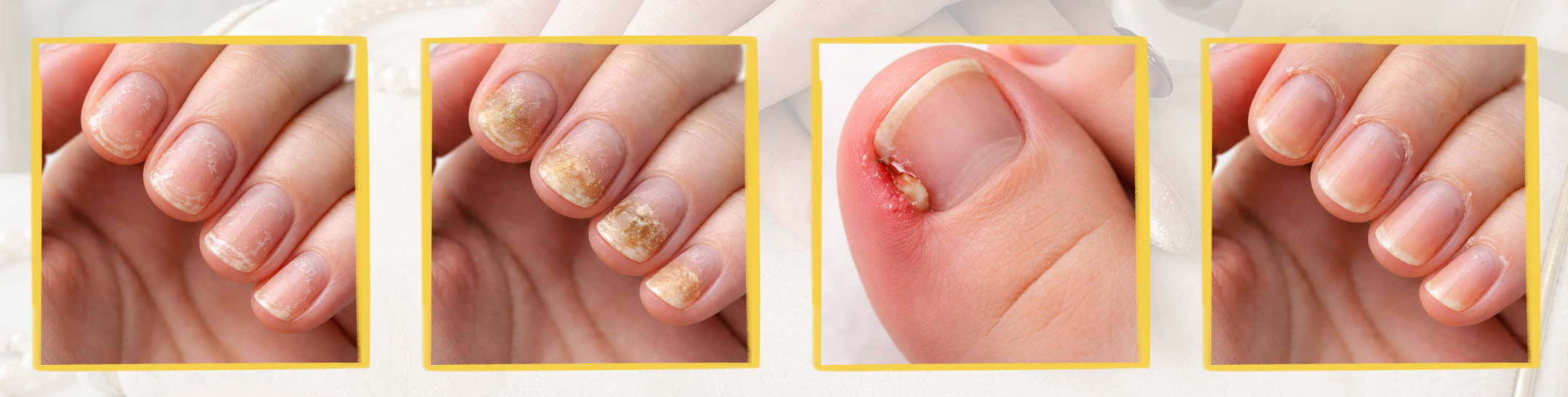 nail Care blog _2_
